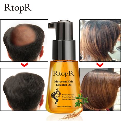 Find Your Hair Loss Solution with Korean Magic Hair Enhancement